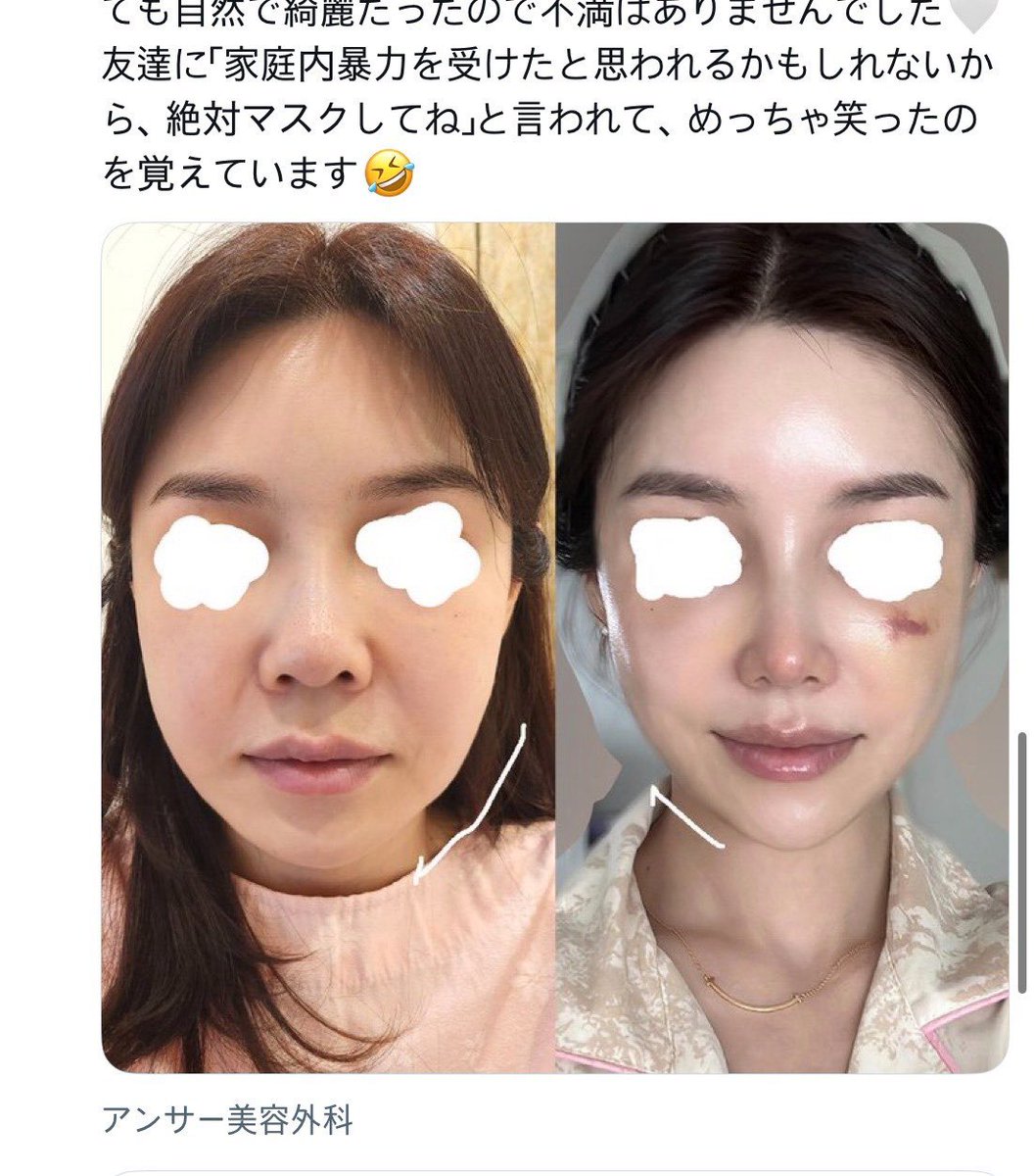 垢抜けメモちゃん tweet media