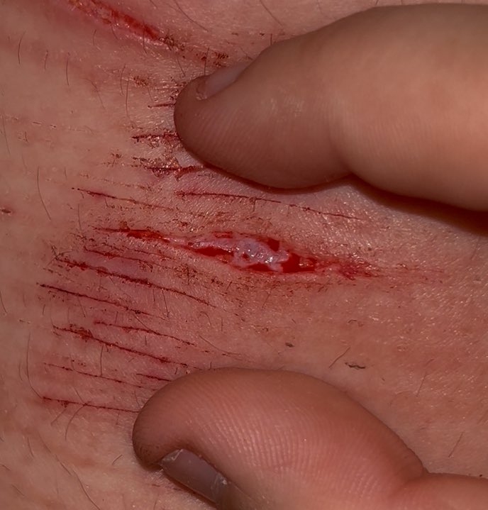 cedar of shtwt tweet media