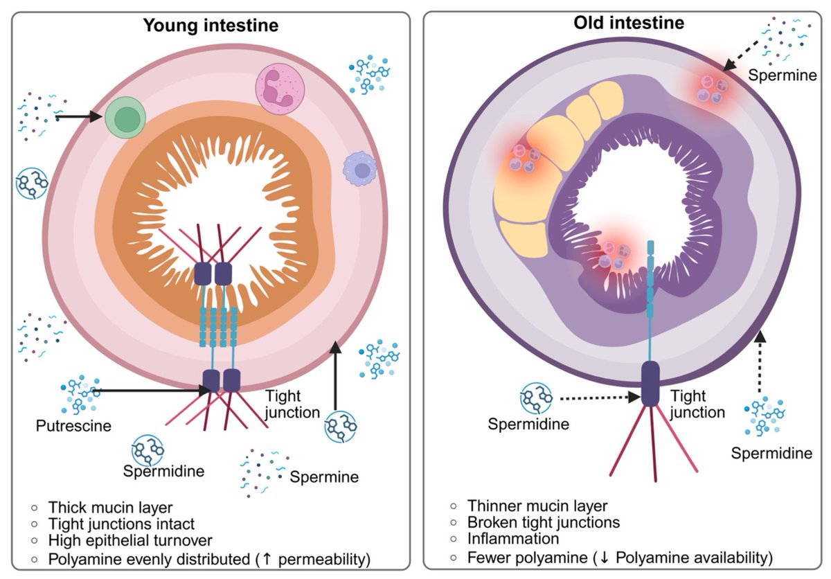 agingdoc1's tweet photo. The Diet–Microbiota–Polyamine Axis in Intestinal Aging: Microbial Pathways, Functional Foods, and Physiological Implications

https://t.co/UJwPyVroBn https://t.co/xQTAAszA0w