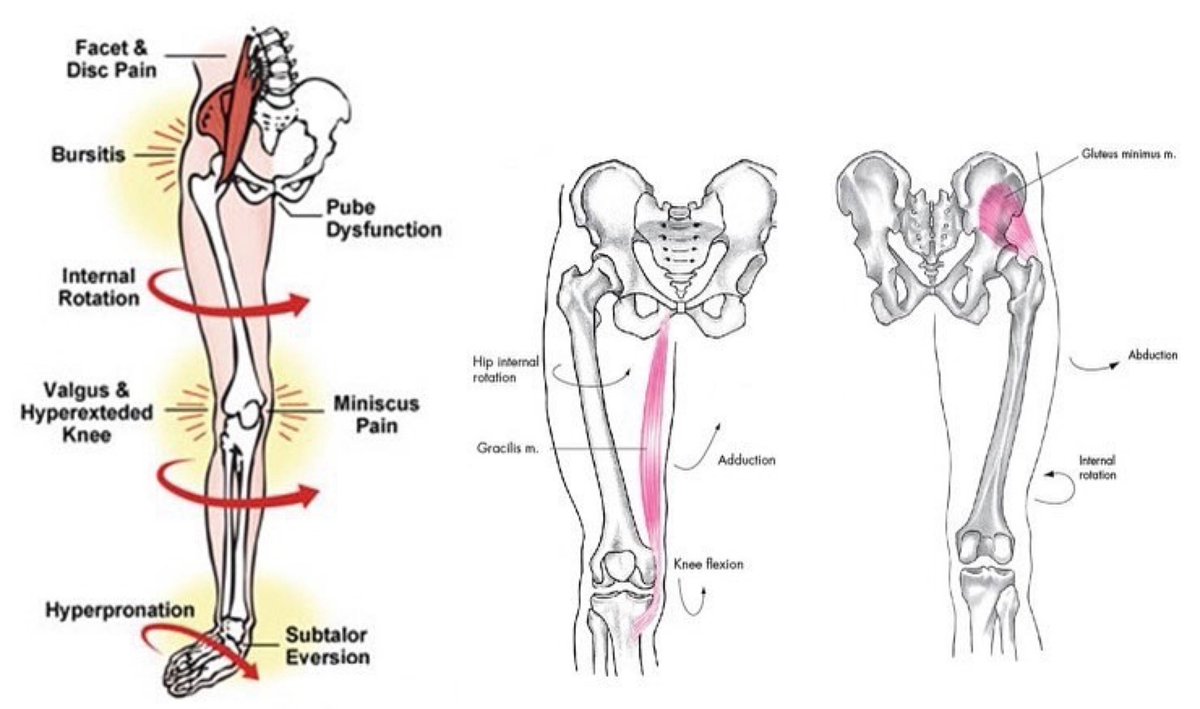 PhysioOsteoGram's tweet photo. WHY YOUR FOOT ARCHES ARE SO IMPORTANT

Proper arch mechanics allow for shock absorption when we walk. This requires the right amounts of both pronation and supination in the same… https://t.co/sWAt2mAmxi https://t.co/caNuuhVWw0