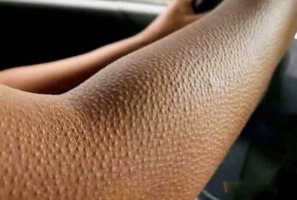 Dude 2.0 tweet media