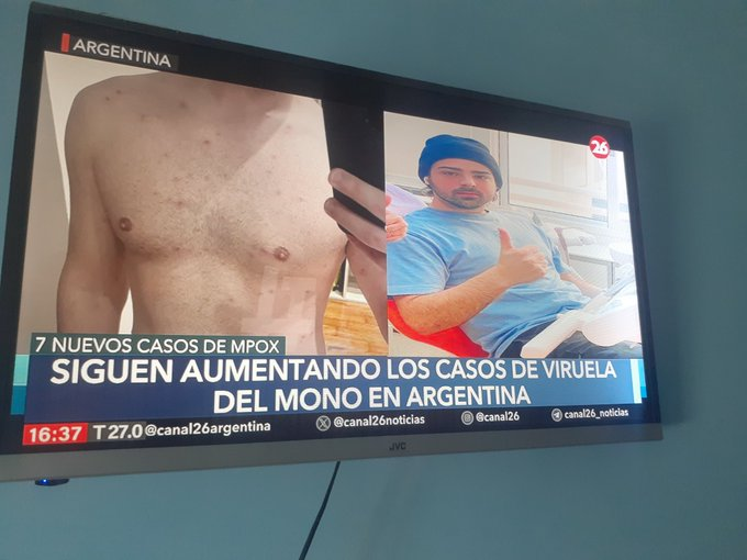 "el tipo mas limpio del stream" cuando existe este tipazo que su mayor polemica fue tener viruela del mono en 2024
