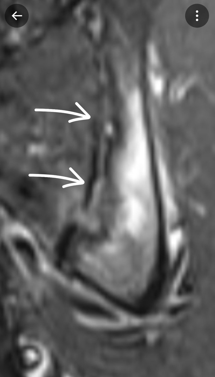 Angelo Cacchio, MD,PhD,MSSc,MPT tweet media