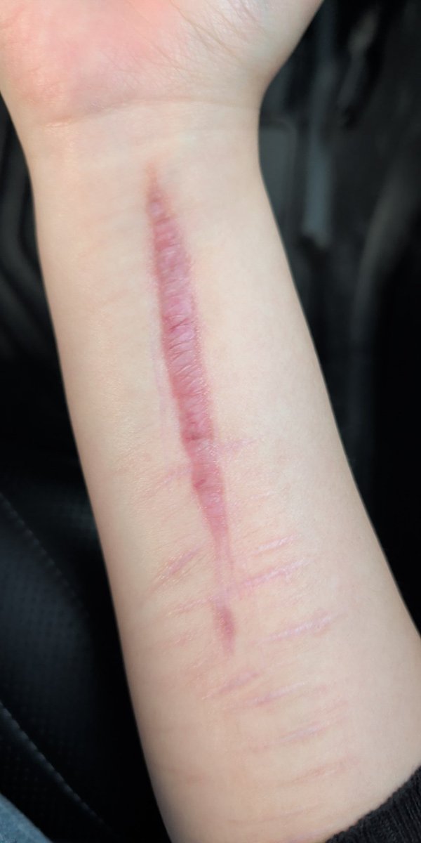 »simon's corner || shedtwt« tweet media