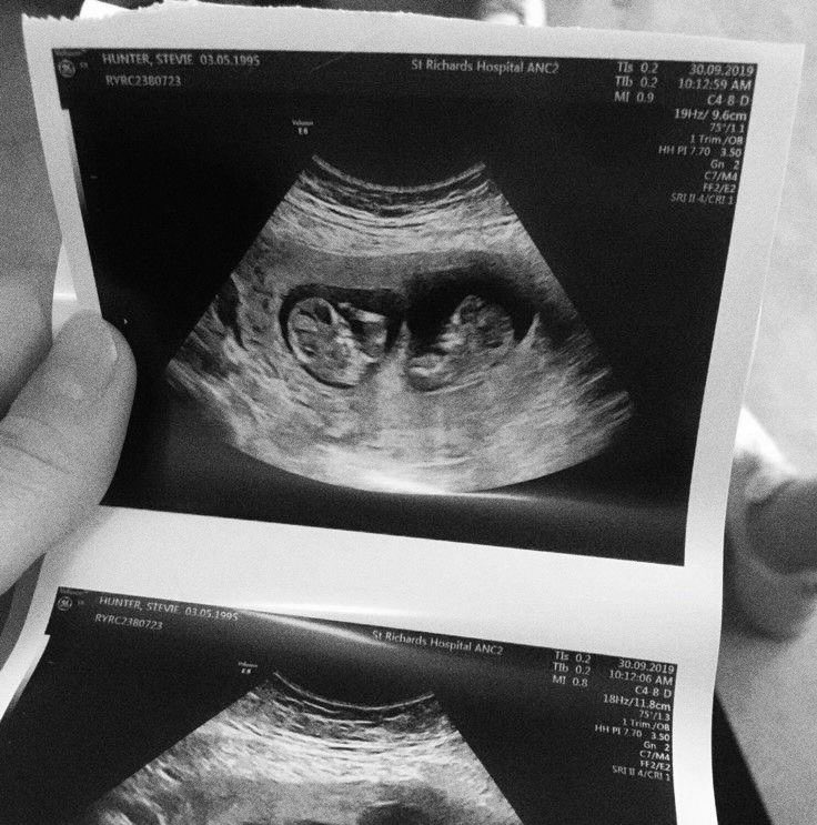 Cordeliɑ; 𝒎𝒐𝒎 to be ✦ ｡* tweet media