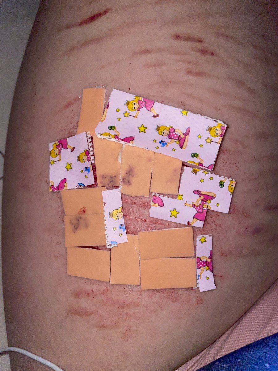 vaggasoaris's tweet image. Peak aftercare?