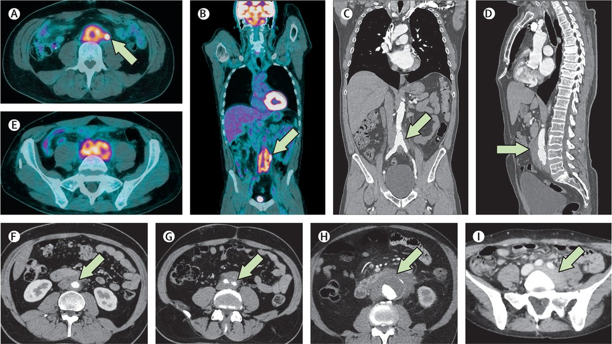 The Lancet tweet media