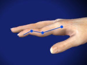 Mastering the Differential 🩺 tweet media