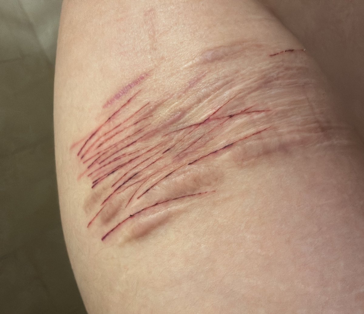 june ☢︎ tweet media