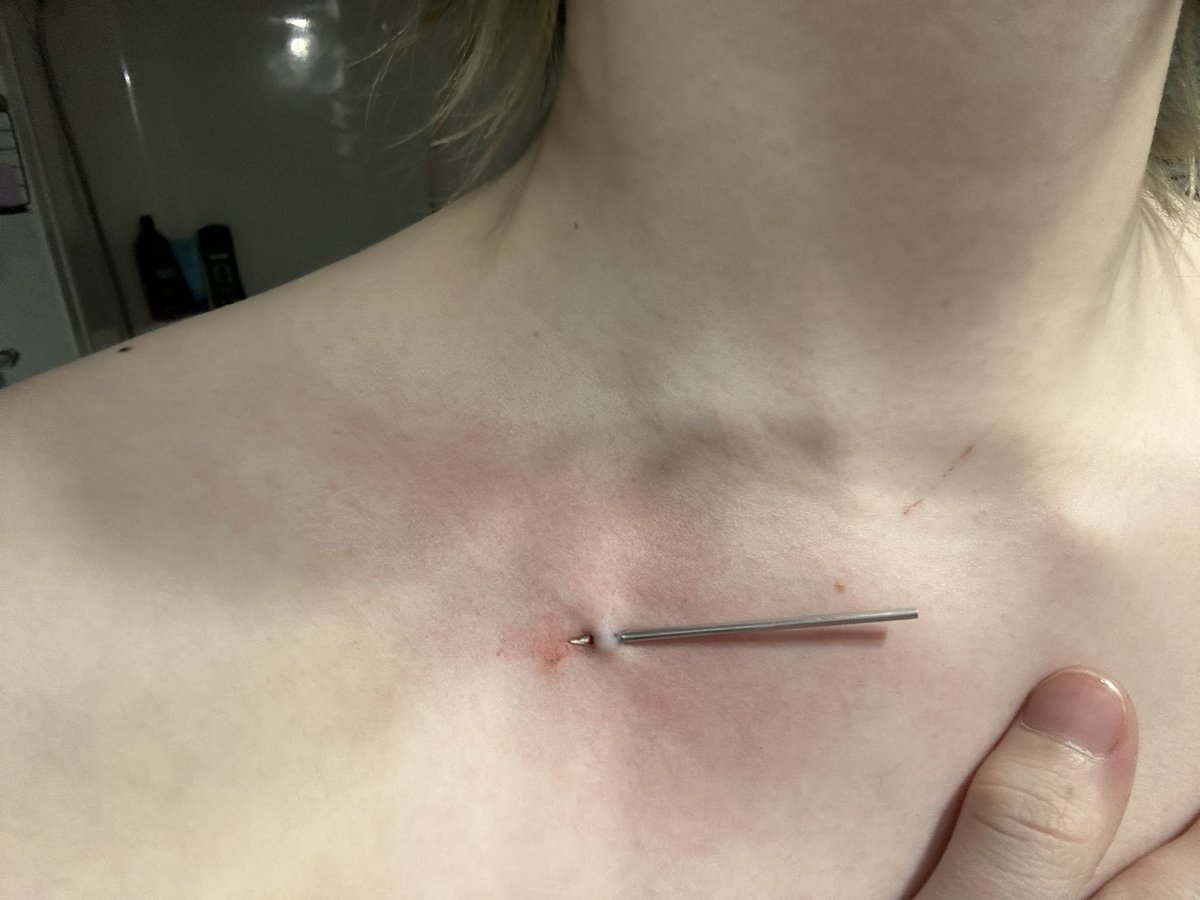 Skyler — tweet media