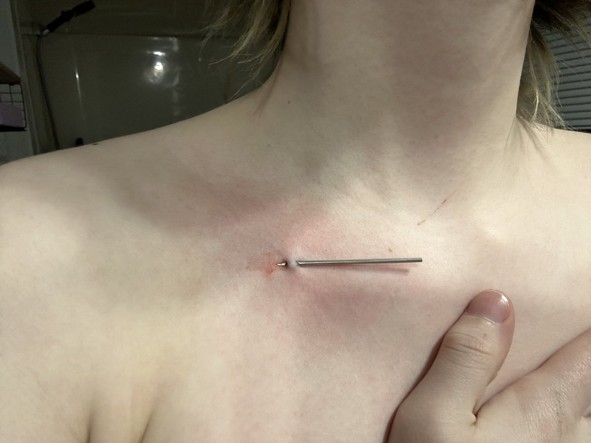 Skyler — tweet media