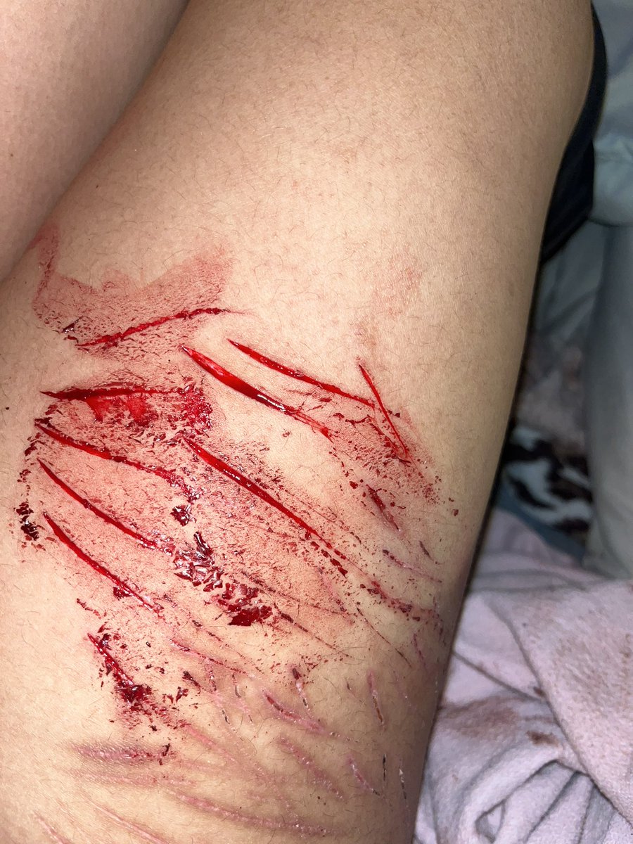 siqnes_'s tweet photo. not taking ur meds have consequences LOL #shedtwt #sh https://t.co/9wwawWFeMJ