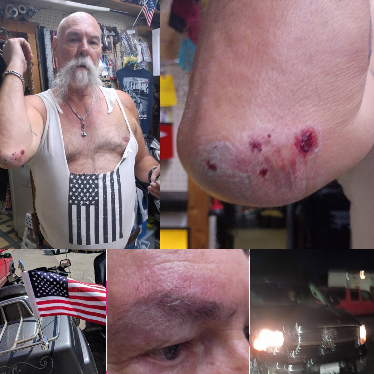 HoldingOntoHope's tweet photo. A drunk Mexican man we've known for years chose violence over us displaying the US flag.
Police considered it mutual combat. yet we didn't start it and there was no way to walk away.
To me, the flag represents family, sacrifice, and service. No one should be attacked for that. https://t.co/yzlggAvyS0
