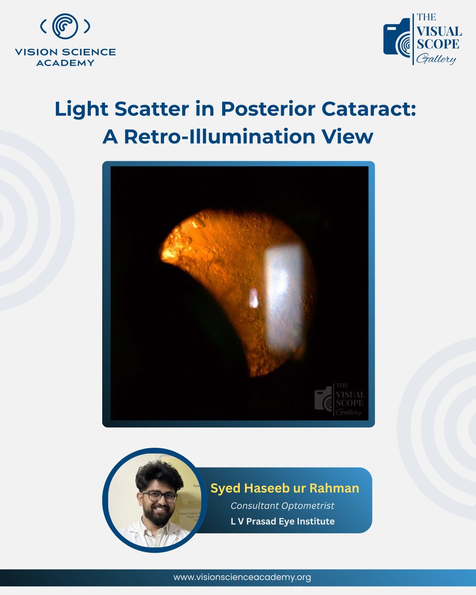 Vision Science Academy tweet media