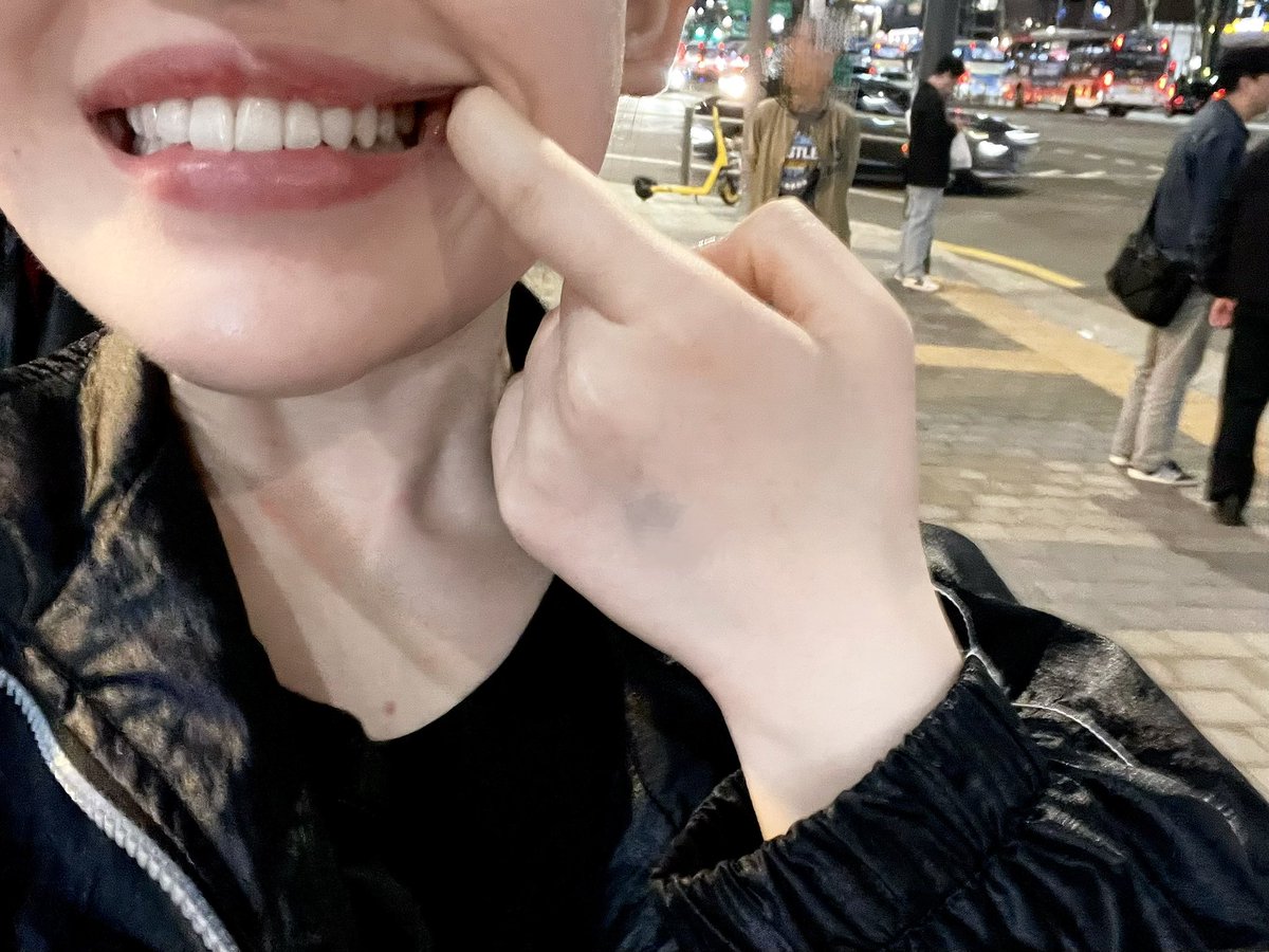 ごりちゃん脂肪豊胸DT🇰🇷5/28-6/2 tweet media