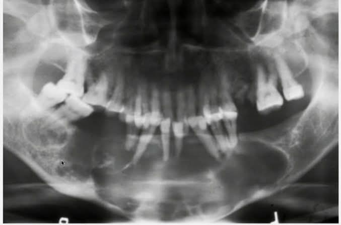 OVIdental GO tweet media