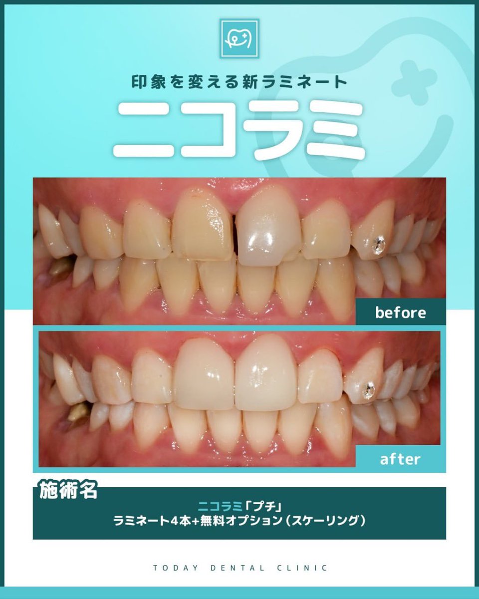 アーノルド・シュワルツゴリみん🦍 tweet media