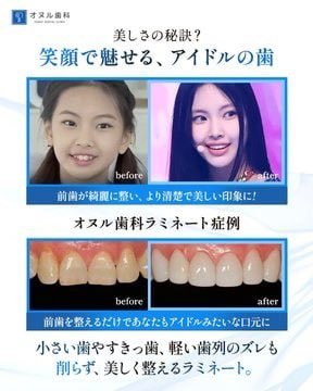 アーノルド・シュワルツゴリみん🦍 tweet media