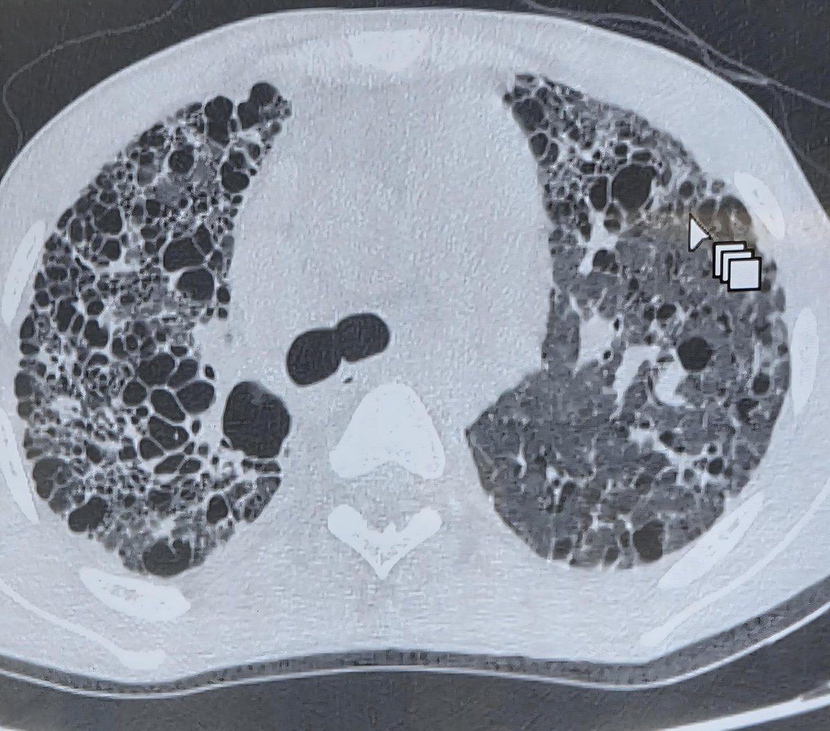 Dr. Fred C. Semitala tweet media