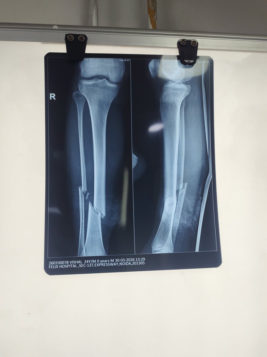 AKASH GUPTA tweet media