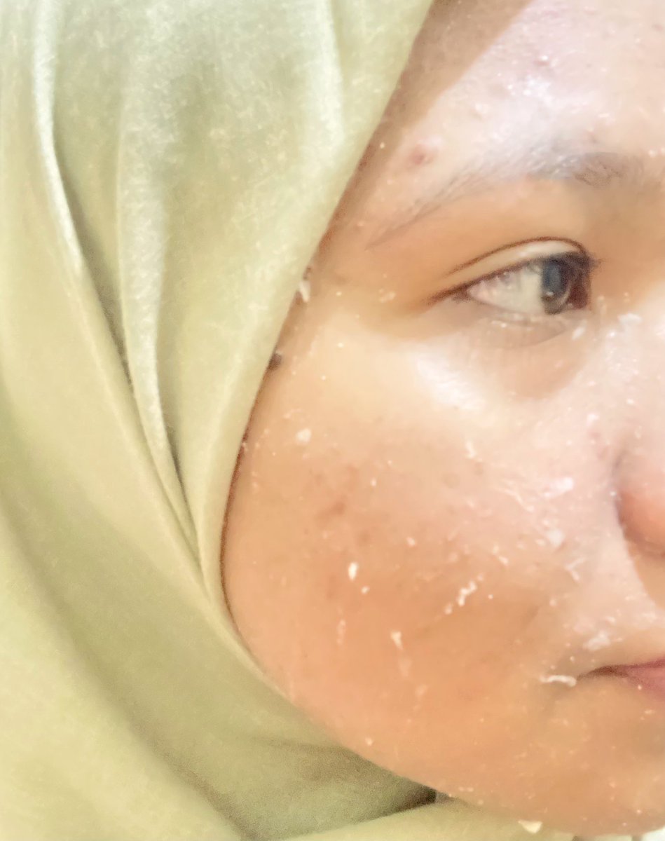 ιℓуα tweet media