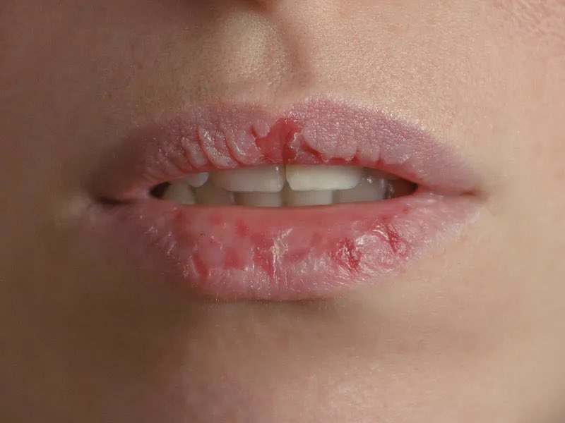 Небелая Овца tweet media