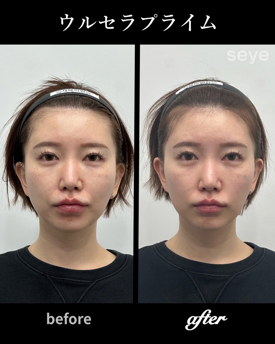 【公式】セイェクリニック 韓国美容 tweet media