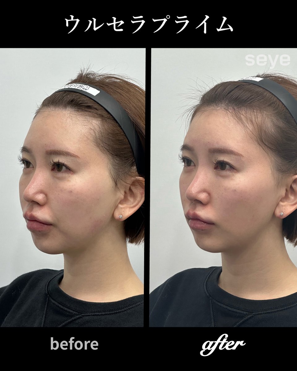 【公式】セイェクリニック 韓国美容 tweet media