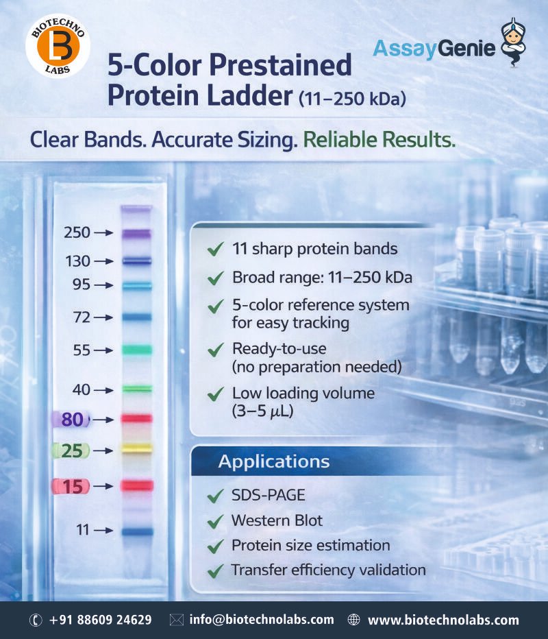 biotechnolabs's tweet image. BTL Biotechno Labs Pvt Ltd is pleased to introduce the 5 Color Prestained ProteinLadder (11–250kDa) designed to simplify workflow and deliver reliable results every time.
#WesternBlot #SDSPAGE #ProteinLadder #Proteomics #Proteinsizeestimation #AssayGenie #BTLBiotechnoLabsPvtLtd