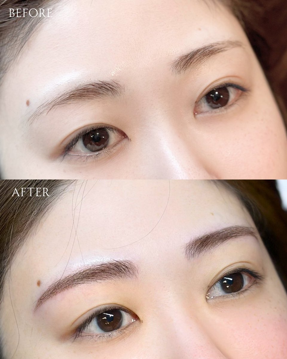 ソウル皮膚科🩵リー・アンド・クル tweet media