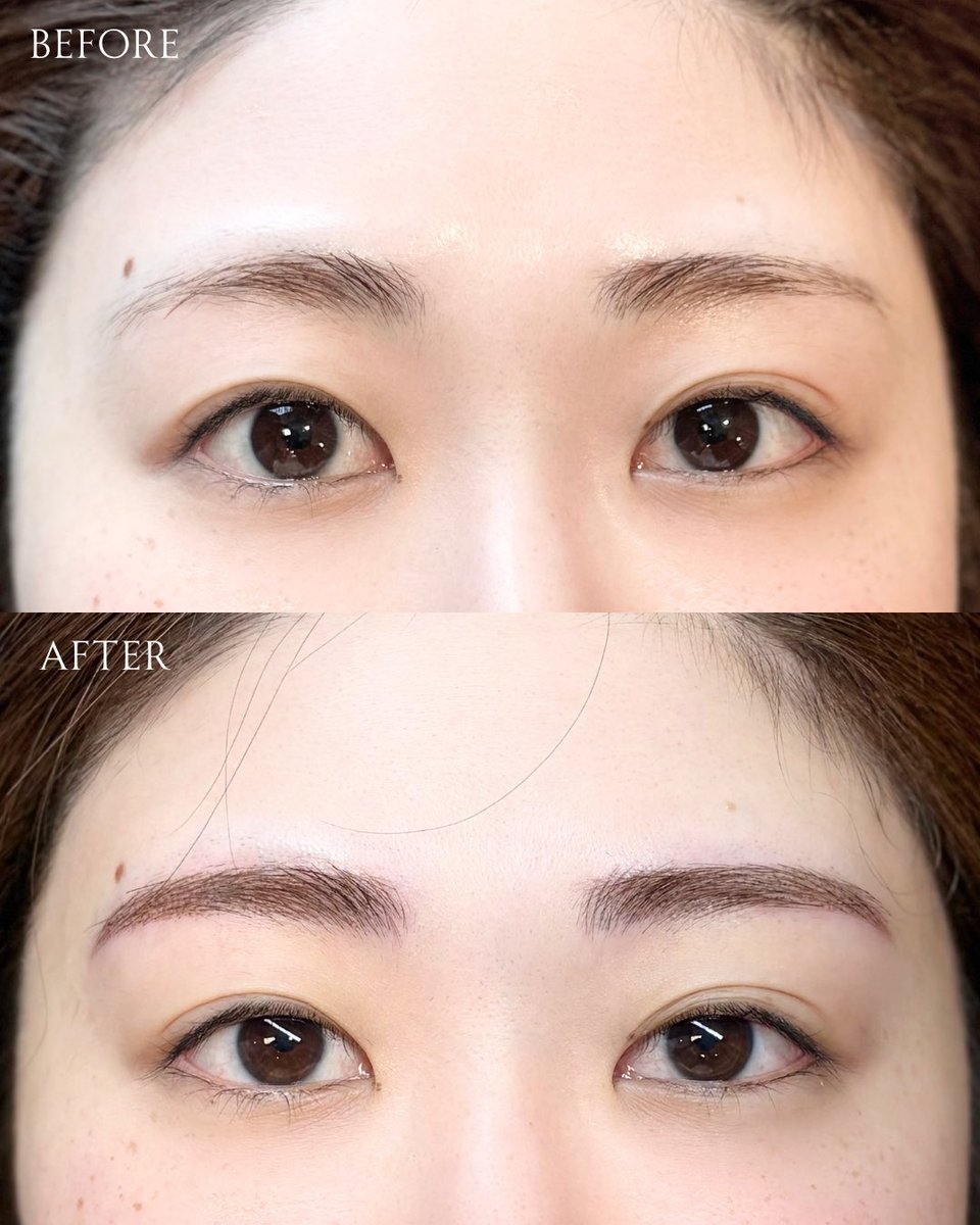 ソウル皮膚科🩵リー・アンド・クル tweet media