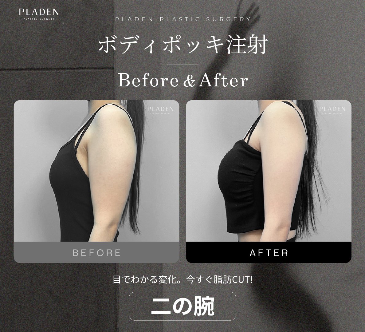 【公式】プラデン美容整形外科 tweet media