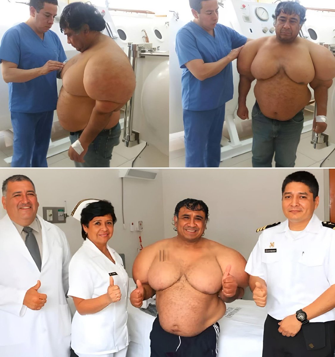 In 2013, off the coast of Pisco, Peru, diver Alejandro “Willy” Ramos set out for what should have been a normal day of fishing. But fate had other plans.

A passing boat accidentally cut his oxygen hose, forcing Willy to ascend immediately skipping the slow decompression that