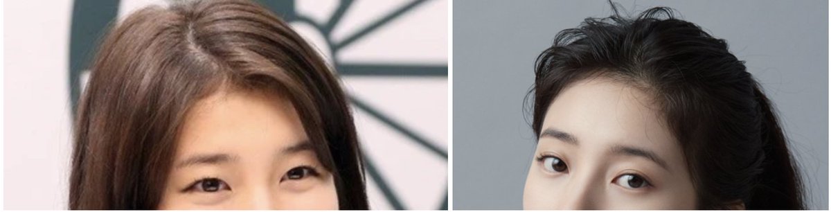 ieulps_jp's tweet photo. 韓国で「美人」と言われる女性アイドル✨

実はほんの少しの変化で、印象が大きく変わっているのをご存じですか？
その違い、気になりませんか？👀
イウルではすでに取り入れている施術です✨

今回は「リフト」についてご紹介します💎

＃韓国 ＃韓国アイドル ＃美容外科 ＃額リフト ＃アンチエイジング
＃美容整形 ＃韓国美容 ＃リフトアップ ＃若返り ＃小顔
＃イウル ＃韓国クリニック ＃ビフォーアフター ＃垢抜け ＃フェイスライン