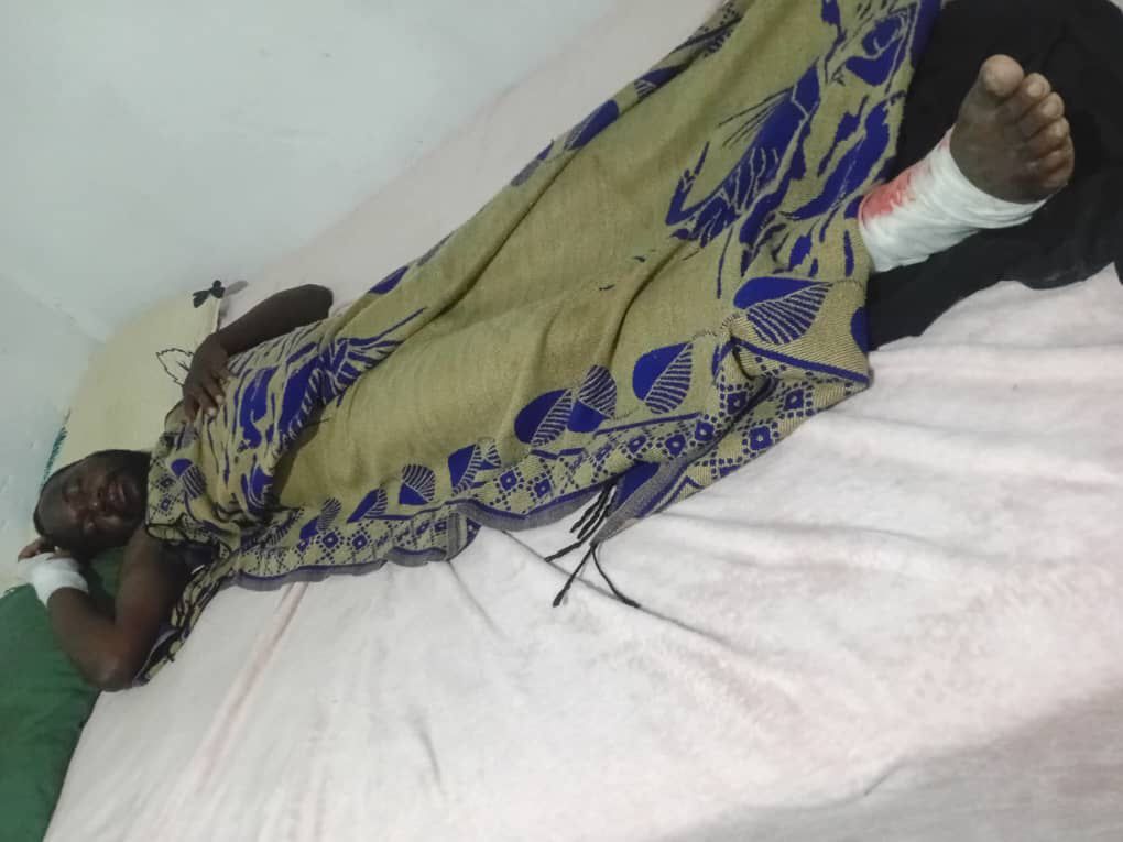LeaderGeneral1's tweet photo. 1/2 🚨 OUTRAGE IN CHIREDZI 🚨
A peaceful citizen, Gilbert Mutubuki, was brutally attacked by knives simply for trying to exercise his right to speak at a public consultation. This is not democracy, it is violence and intimidation. @daddyhope @Sophie_Mokoena @MacBelts @Chofamba https://t.co/tsxOZoYjBL