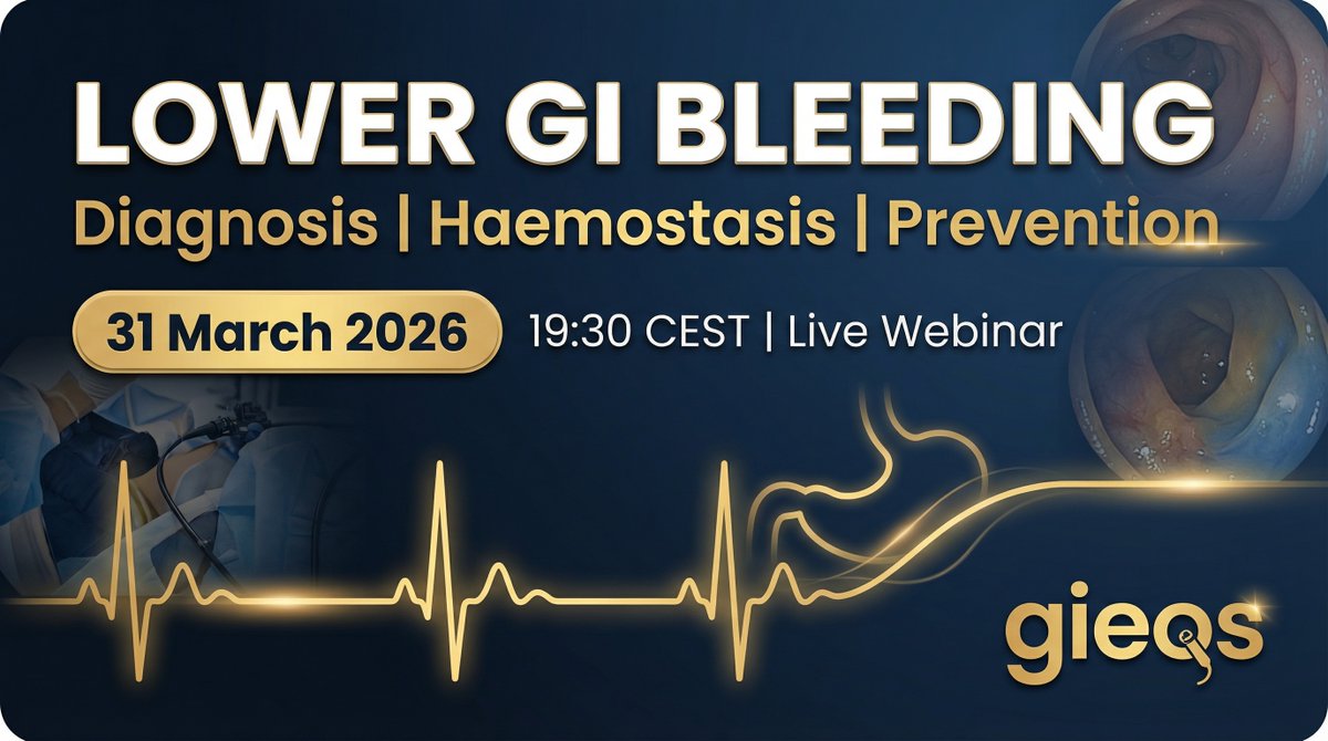 gieqs_symposium's tweet image. ⏰ STARTING IN 1 HOUR! 

Lower GI Bleeding Webinar -- 19:30 CEST 📲

3 expert lectures. Panel discussion. 90 minutes.  

Join live or catch the full recording immediately after.  

gieqs.com/courses/lower-…

#GIEQs #Endoscopy #GIBleeding #LowerGIBleeding #MedEd