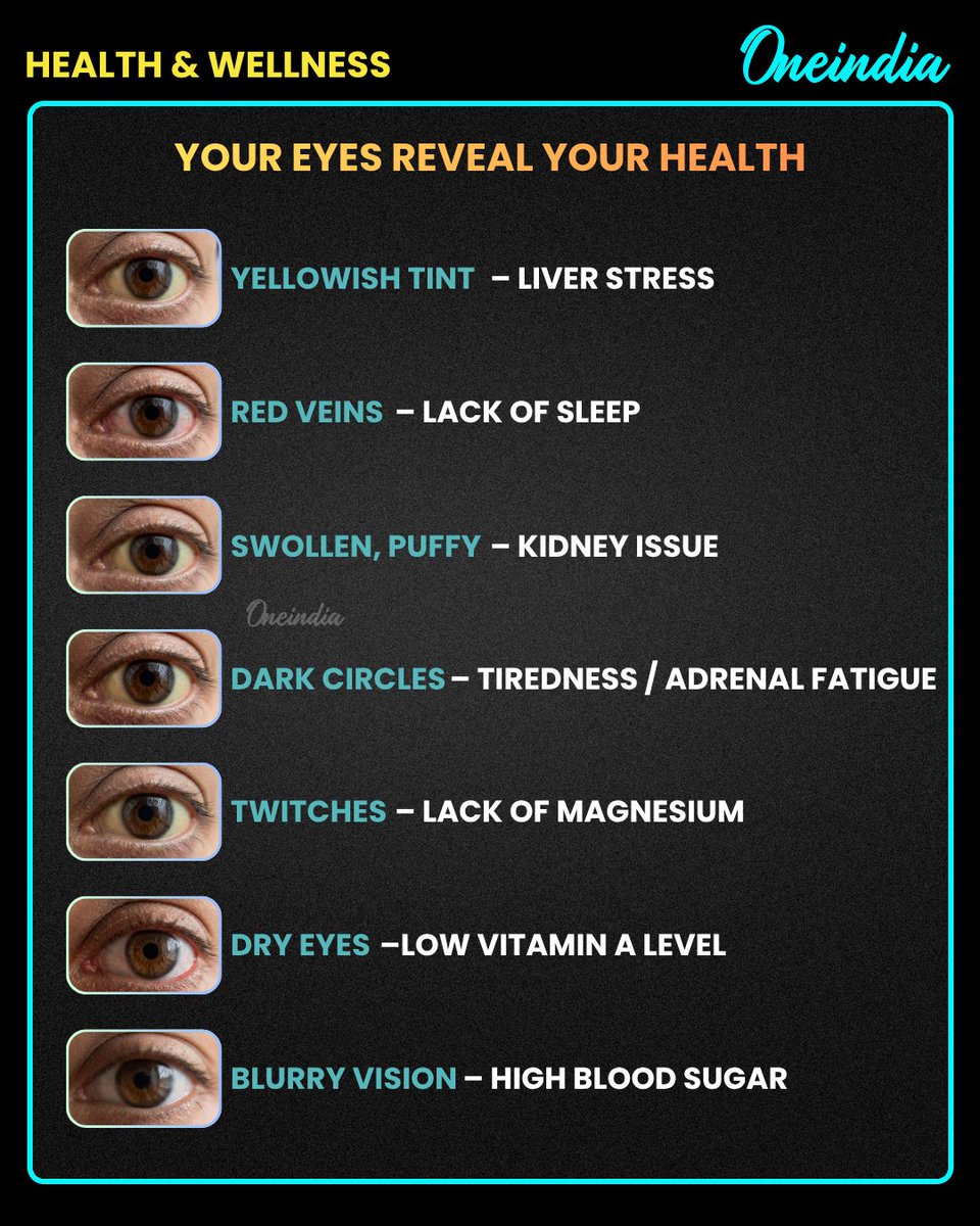 Oneindia's tweet image. Your Eyes Reveal Your Health: Warning Signs You Shouldn’t Ignore

#EyeHealth #HealthTips #HealthyLiving #VisionCare #EyeCare #Wellness #HealthAwareness #OneIndia #healthandwellness