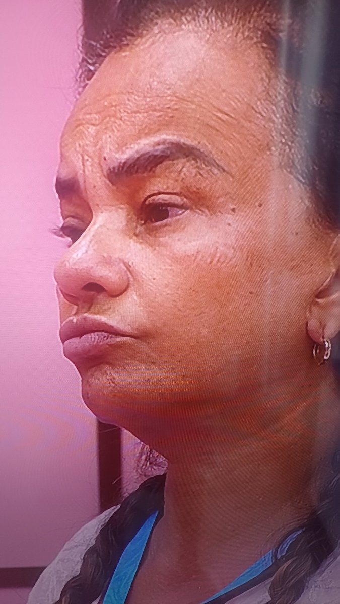 CostaGabri78462's tweet photo. @centralreality #ForaSolangeCouto cara de cu https://t.co/66dve00T4X