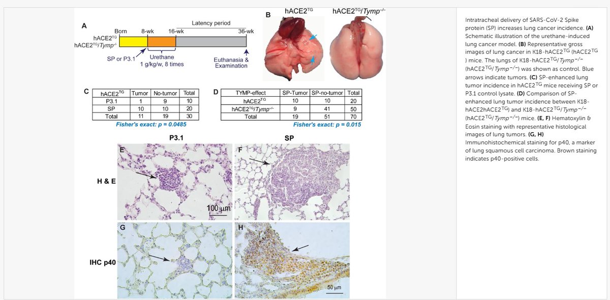 HarrySpoelstra's tweet photo. Thymidine phosphorylase promotes SARS-CoV-2 spike protein-driven lung tumor development

🚨So, there you have it AGAIN, what if the lingering damage from COVID-19 isn't just “long COVID”..... but also a hidden driver of LUNG CANCER?

➡️New very interesting USA/Israel study reveals the SARS-CoV-2 spike protein ramps up thymidine phosphorylase (TYMP), fueling lung injury, fibrosis, and tumor growth, especially in smokers:

“SARS-CoV-2 SP drives lung injury, fibrosis, and tumorigenesis through a TYMP-dependent mechanism involving STAT3 signalling and inflammatory microenvironment remodelling.”

“COVID-19 significantly increases lung cancer risk, especially in current smokers.”

“TYMP represents a potential therapeutic target to mitigate long-term pulmonary consequences of COVID-19.”

‼️In conclusion, according to this study, COVID-19 isn't over when the virus leaves, it may be planting the seeds for lung cancer, and blocking TYMP may be the key to stopping it.  Meanwhile, preventive  post-Covid-19 monitoring  is a must, especially with smokers!
#AvoidSars2 #AvoidReinfections
https://t.co/z1iUb8z71r