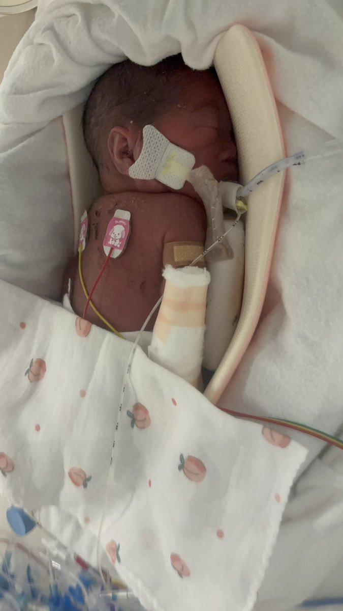 たま@超早産双子のパパ tweet media