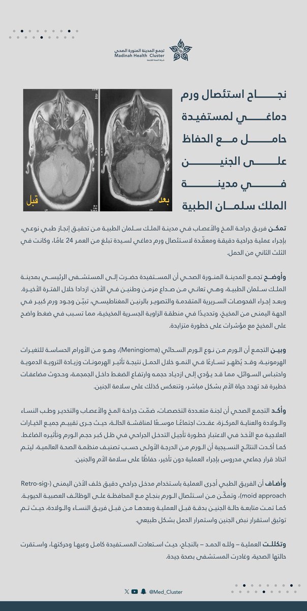 تجمع المدينة المنورة الصحي | MHC tweet media