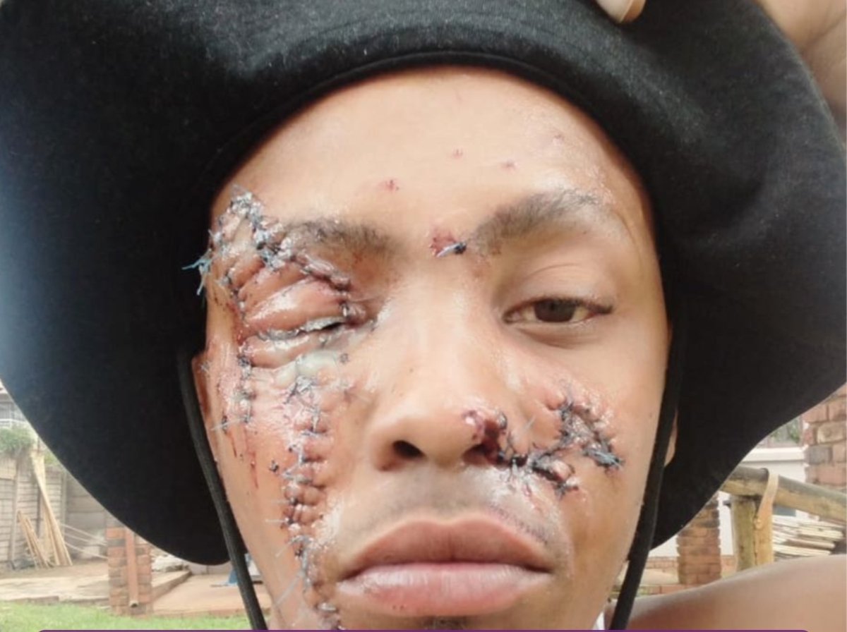 BuzzLifenews's tweet photo. ICYMI: Friends rally to save beloved singer after brutal attack

Shock and heartbreak have gripped friends and fans of Koketso Lumko Langa after the beloved vocalist and makeup artist was brutally stabbed just days after celebrating his 29th birthday.

Known for his rich, soulful voice on Buhlebendalo’s #FamBand and his proud presence in the Mzansi Gay Choir, Koketso has long been a light in his community — not just through music, but through his artistry as the force behind Makeup by Lumko Langa. 

Now, that same community is fighting to help him heal after a violent attack that has left many shaken and outraged. 

The horror unfolded on Friday, 20 March 2026, when Koketso was allegedly attacked by a man known to him as Karabo. The incident, believed to be a homophobic attack, has sparked anger and calls for justice across social circles and online platforms. Friends say the vibrant performer, known for uplifting others with his voice and talent, is now facing a long road to recovery — physically, emotionally, and financially. Medical bills are mounting, and the trauma of the attack has left deep scars.

“He didn’t deserve this. No one does,” said a close friend. 
“Koketso has always been about love, expression, and community. Now it’s our turn to show up for him.”

In response, friends and supporters have launched a heartfelt campaign to raise funds for his medical care, legal support, and recovery journey. From small donations to messages of encouragement, the movement is growing as more people rally behind him.

Supporters are also demanding swift action from authorities, insisting that justice must be served and that violence against LGBTQ+ individuals cannot continue unchecked.

Friends have also organised a benefit concert on 9 May, at Untitled Basement to raise funds for his medical care,

The call is simple but urgent: help Koketso regain his smile, his confidence, and his sense of safety. Every contribution — no matter how small — is a step toward healing. As the hashtag #JusticeForKoketso gains momentum, one thing is clear: Koketso is not alone. His community is standing strong, in hope, love, and the fight for justice.

https://t.co/OPGFPGwLDS…