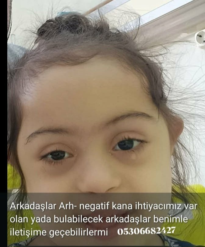 _UrVeKa_'s tweet photo. 🔴 DM'den Geldi 🔴
Bu minik yavrumuzun kana ihtiyaç var
Elden ele paylaşalım lütfen çok acil dediler https://t.co/JdMVS7Pg96
