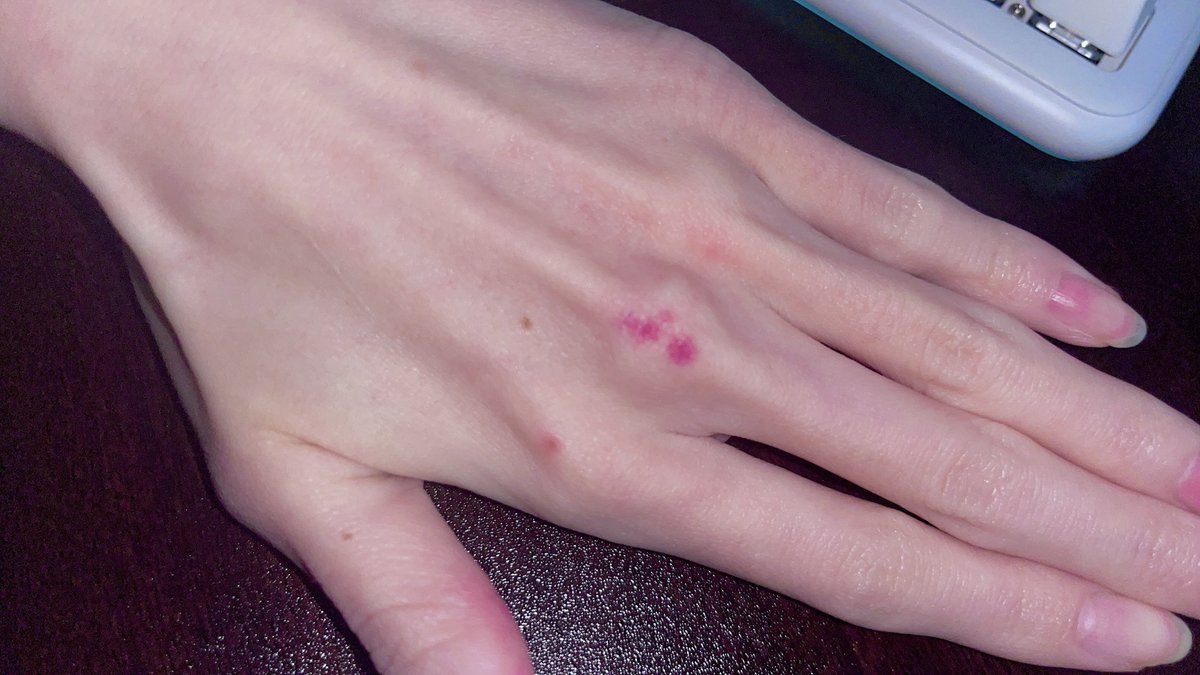 ꒰ঌ ૠ ᤊ ꒫ ໒꒱ tweet media