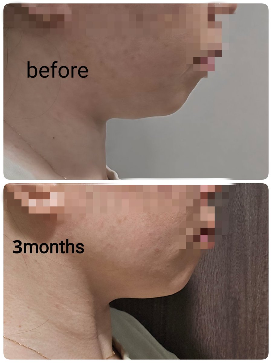 まめこ tweet media