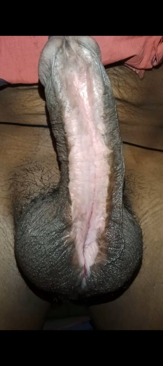 @monster subincision tweet media