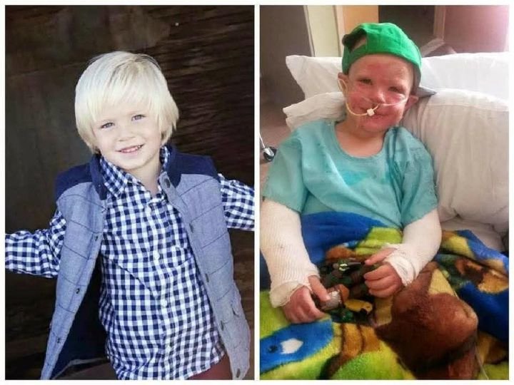 4 Year Old burn in house fire saved him Father died after Please don't move without type Amen🙏🥺🥹