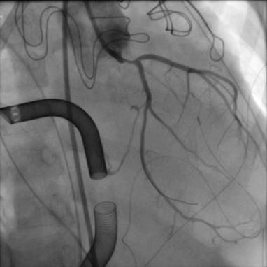 CRM + CRM: Interesting Cases tweet media