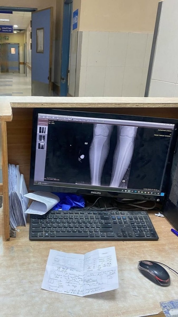 Dr.Yahya in Gaza🍉 🇵🇸 tweet media