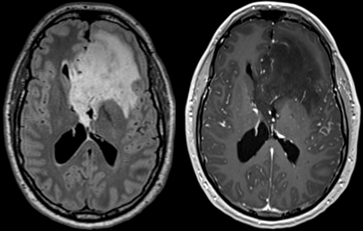 Evan Calabrese, MD PhD tweet media